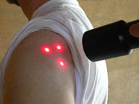 laser on shoulder pain