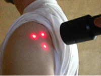 using cold laser on sore shoulder. Wellness22.com, West Hills, CA